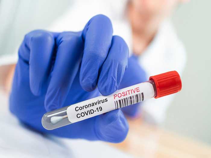 दिल्ली में कोविड के नए 735 मामले दर्ज, 3 मौतें